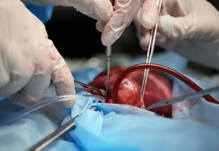 La Sfida dei Trapianti Pediatrici in Italia: Tra Speranze e Difficoltà