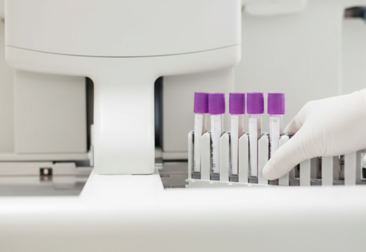 Sepsi, svolta nella diagnosi precoce: un valore dell’emocromo supera i test tradizionali