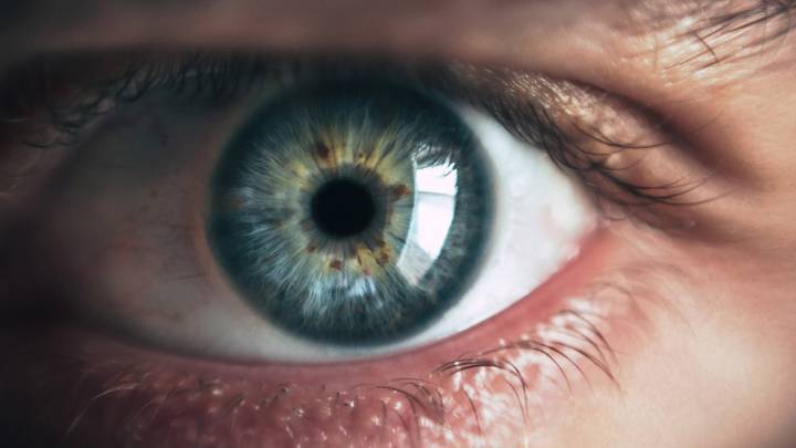 Glaucoma pseudoesfoliativo: una minaccia silente per oltre 100mila italiani